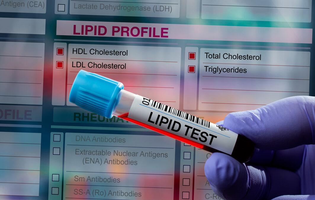 Understanding Your Metabolic Panel Blood Markers: Key Indicators Of Health